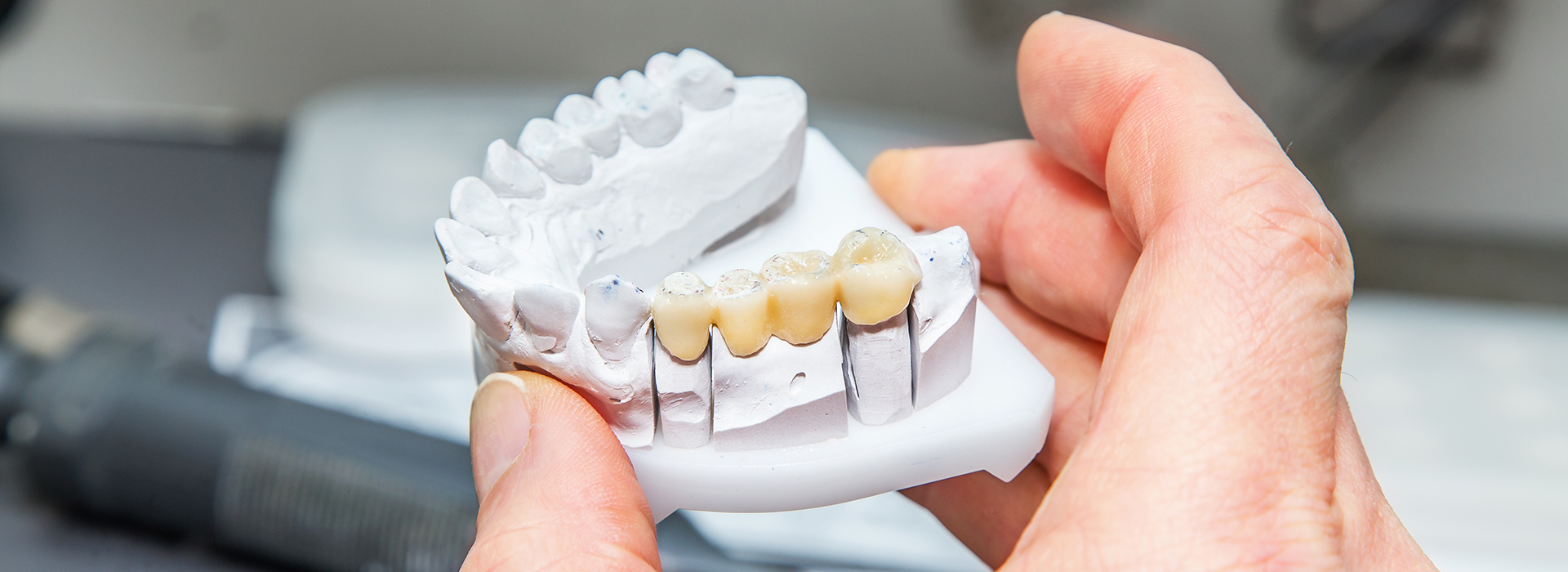 JK Dentistry | Dental Cleanings, Extractions and CBCT