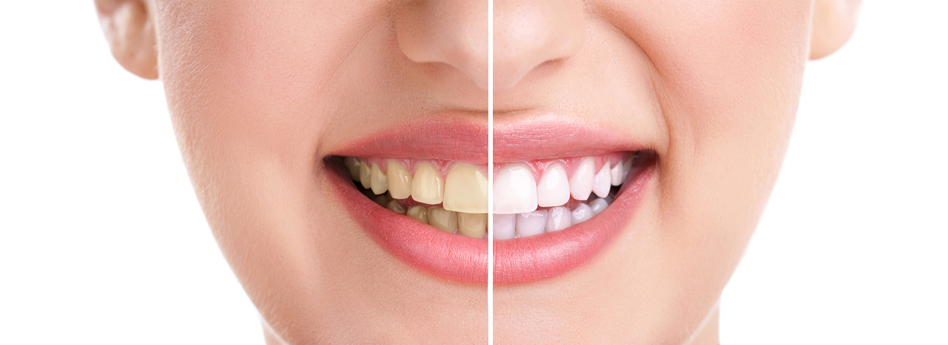 JK Dentistry | Maryland Implants, Pediatric Dentistry and Bone Grafting